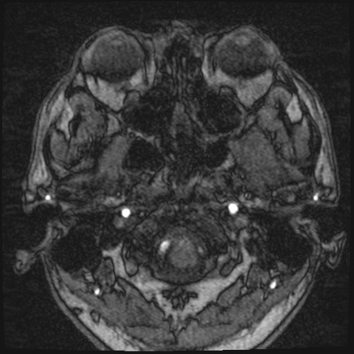 Click on the Serie image to view the images of VILLANUEVA, WILLIAM A.